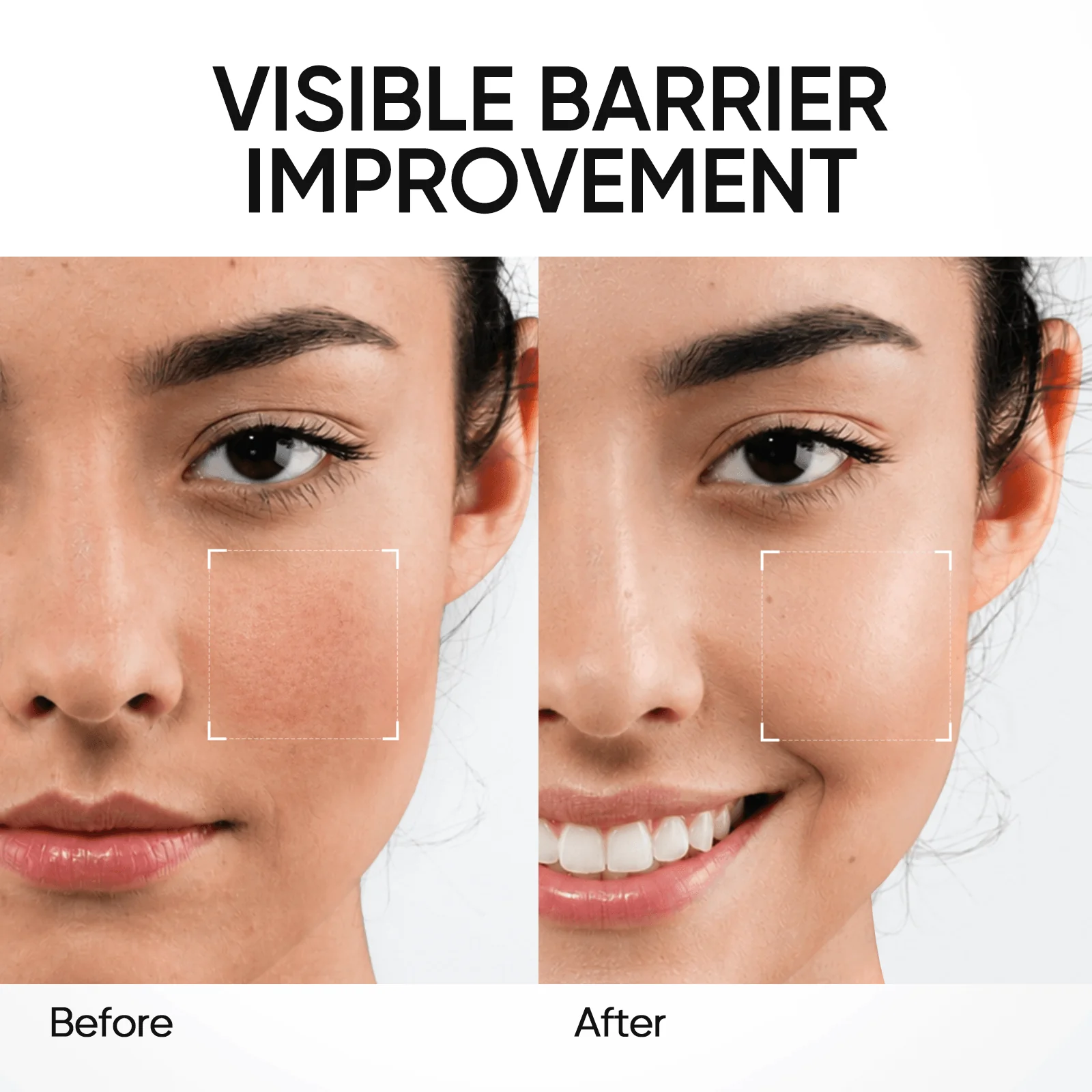 5X Ceramide Barrier Face Moisture Gel Light Texture - Image 3