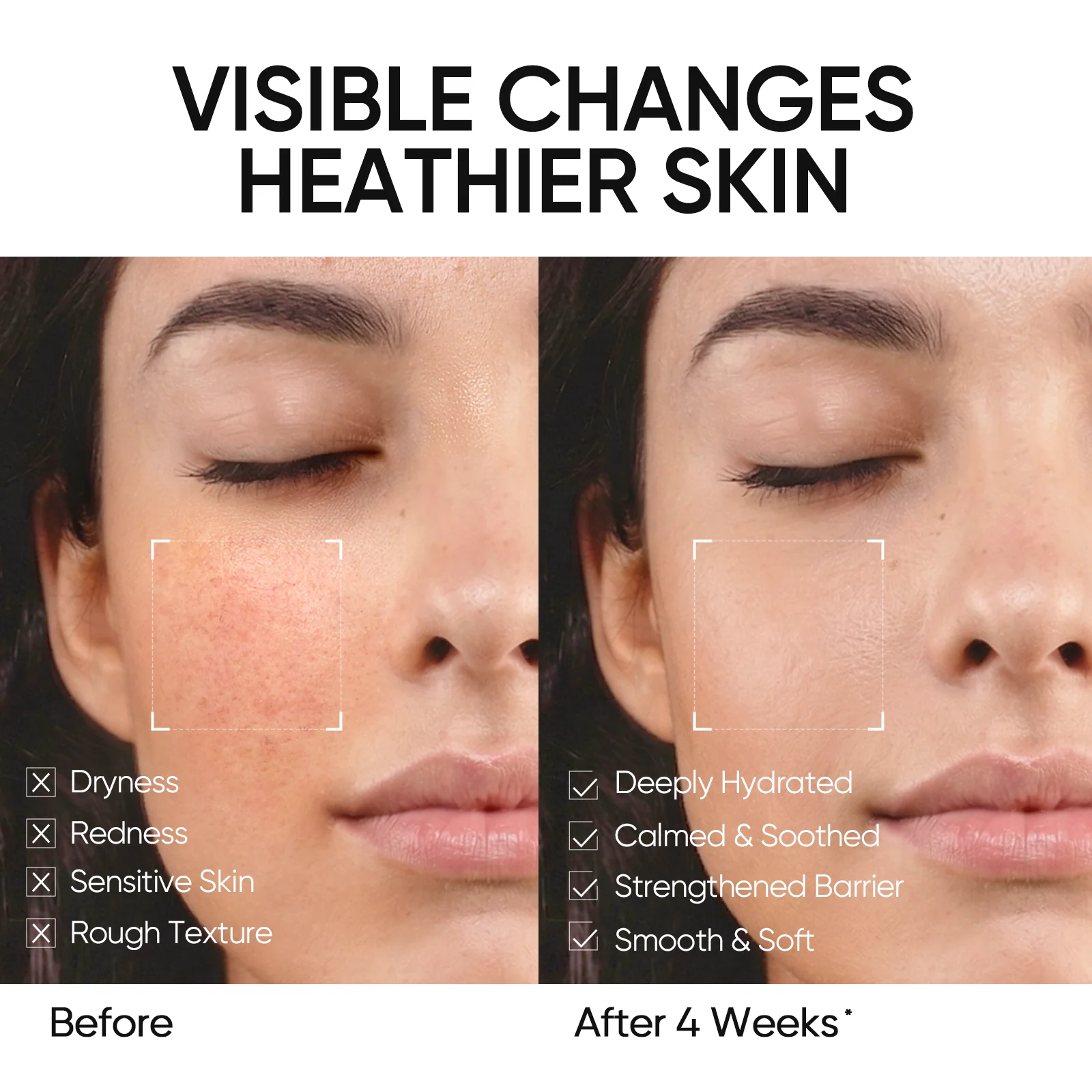 5X Ceramide Barrier Repair Moisture Gel - Image 8