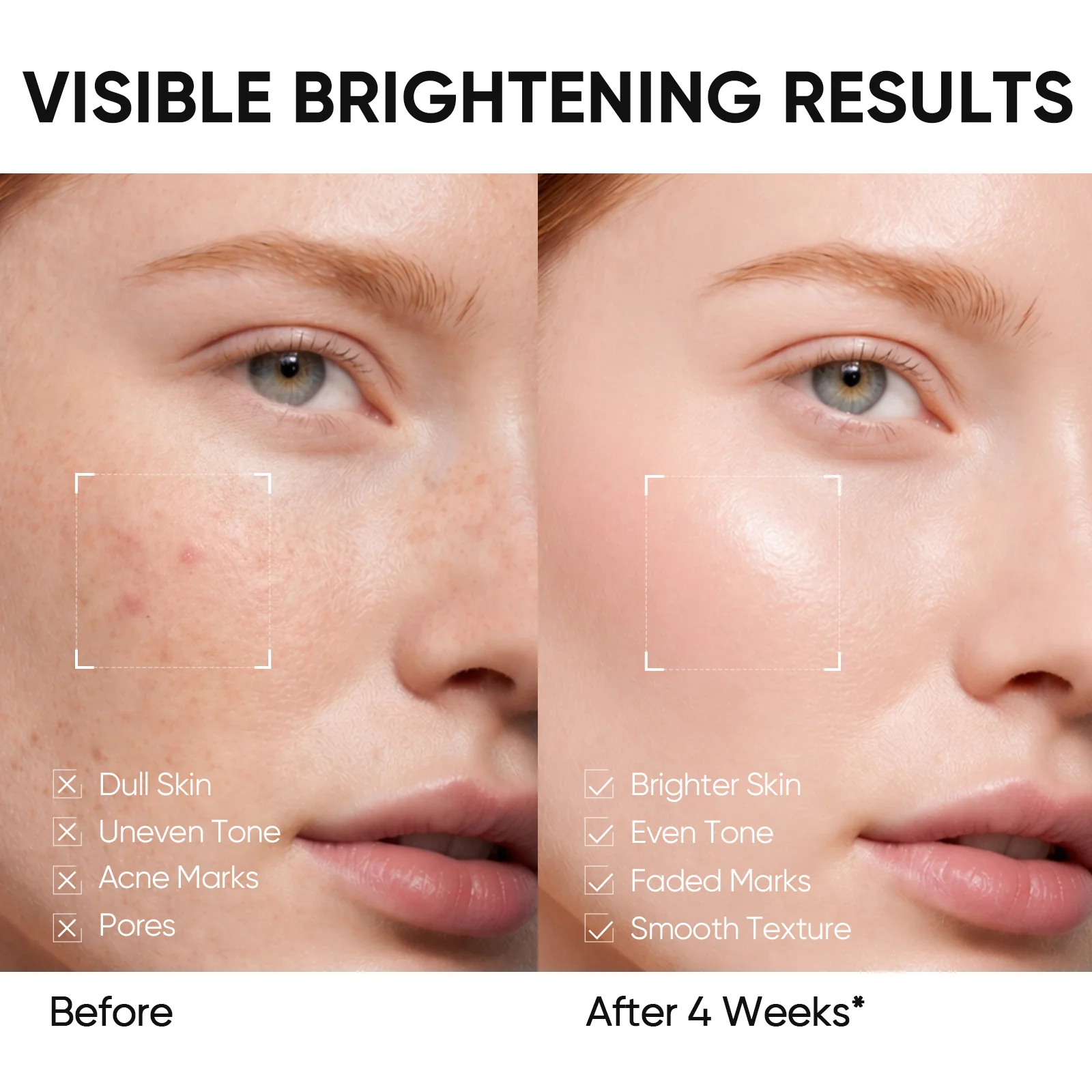 Niacinamide Brightening Set - Image 5