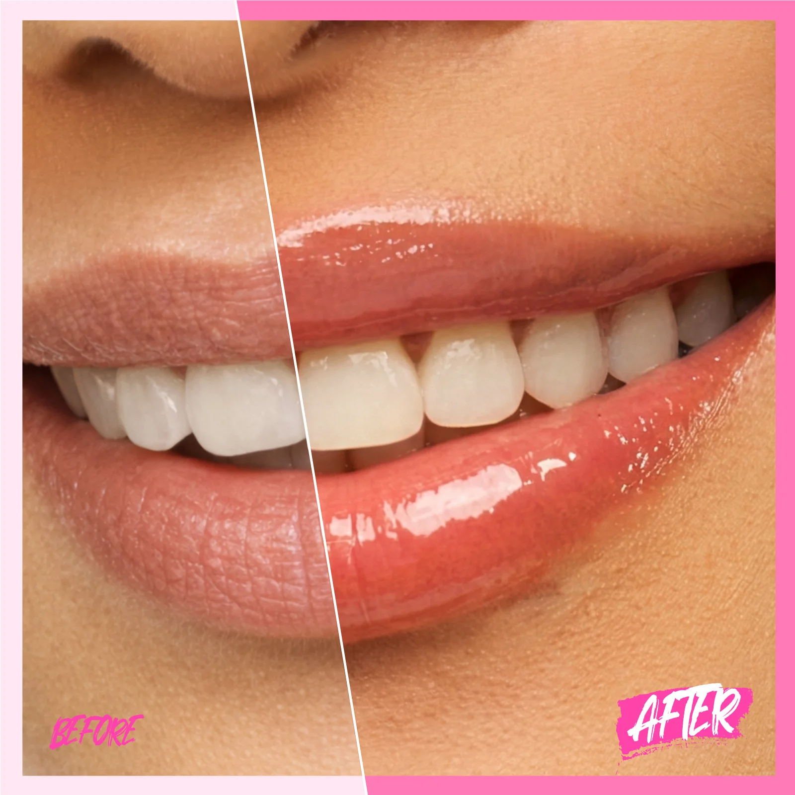 Peptide Brightening Lip Serum - Image 38