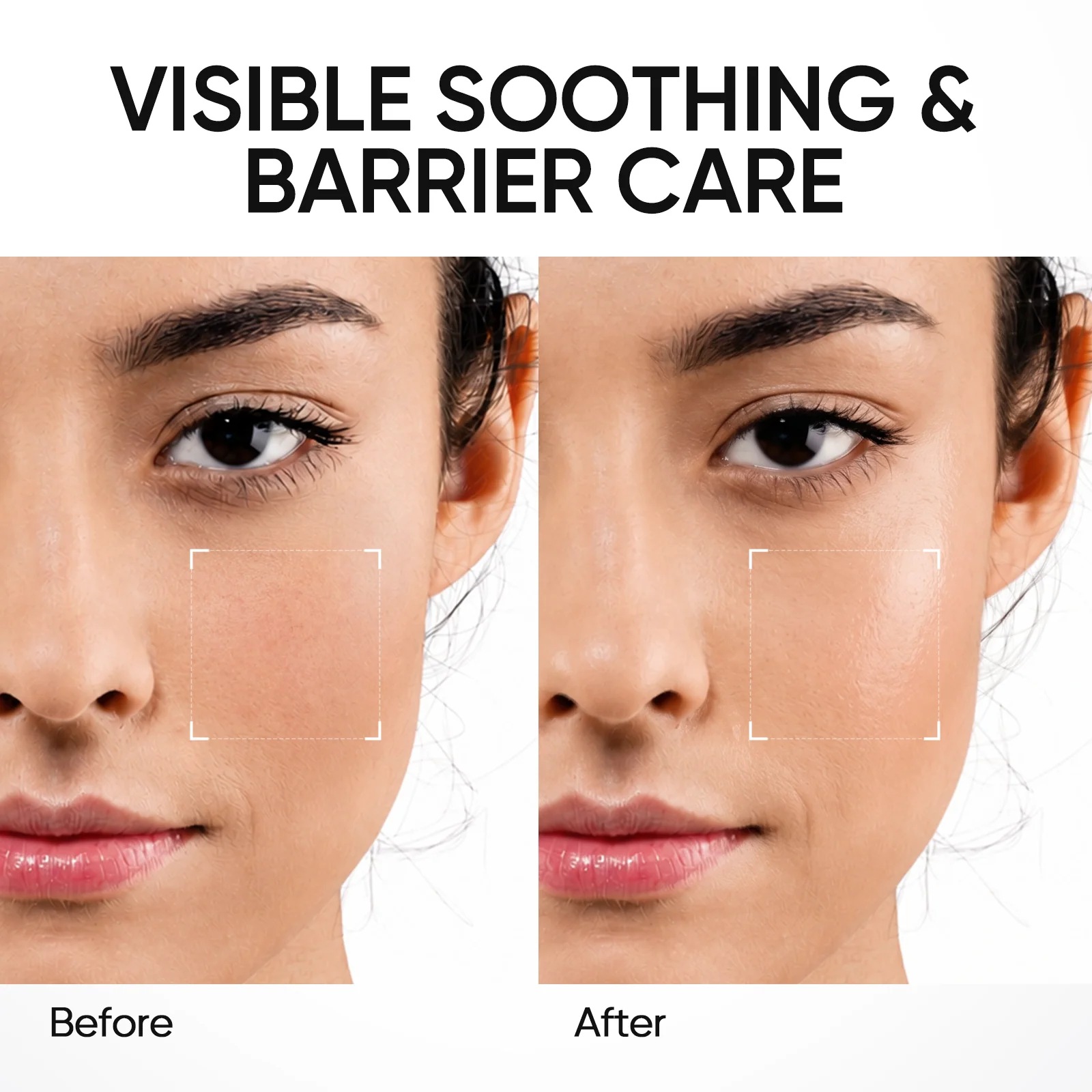 5X Ceramide Skin Barrier Repair Serum - Image 5