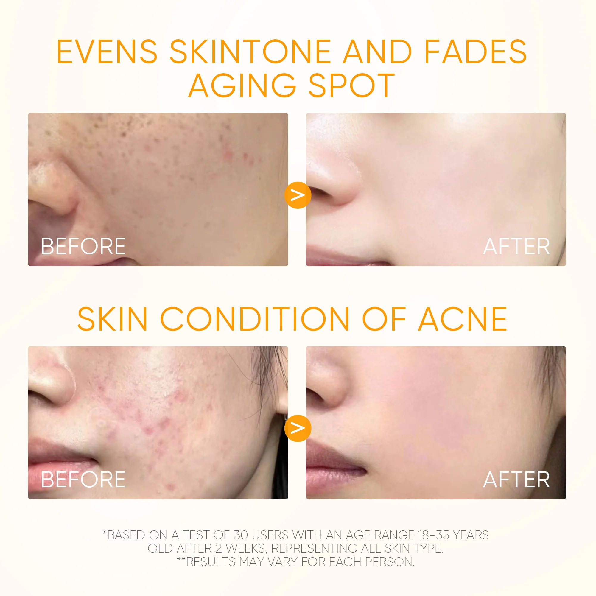 Vitamin C Serum & Moisturizer Set for Dark Spots and Uneven Tone - Image 3